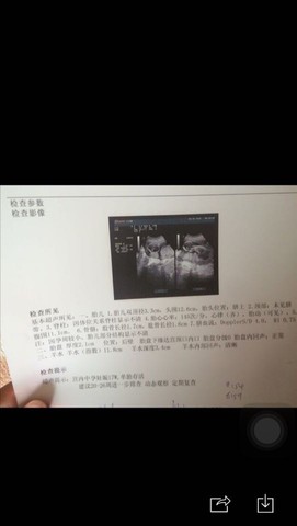 journal_insert_pic_488610814