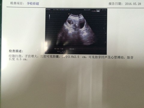 journal_insert_pic_491625717