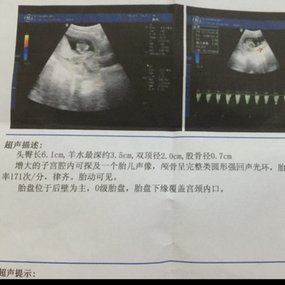 journal_insert_pic_492346778