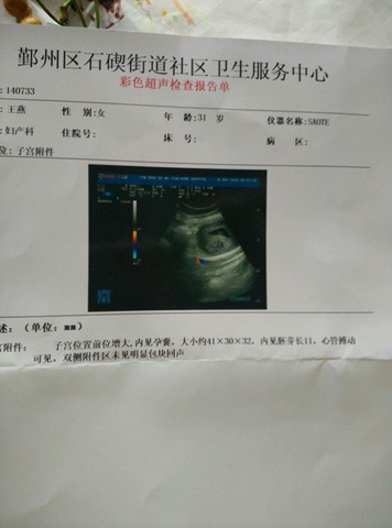 journal_insert_pic_493065224