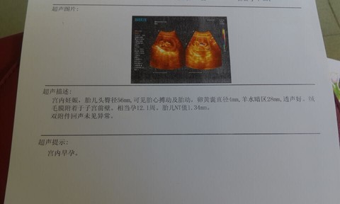 journal_insert_pic_494383792