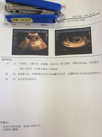 journal_insert_pic_493852402