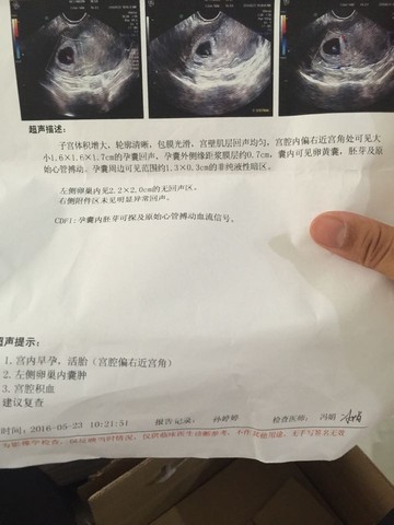 journal_insert_pic_495043521