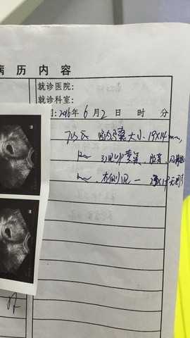 journal_insert_pic_495858612