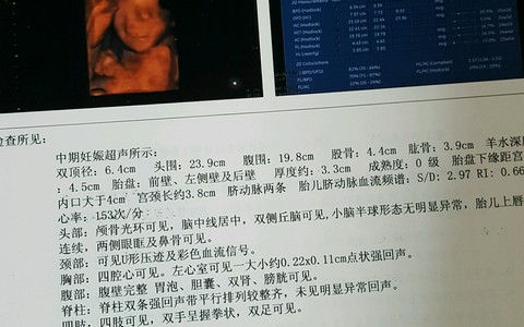 journal_insert_pic_498918495