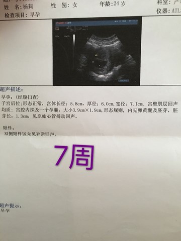 journal_insert_pic_502215671
