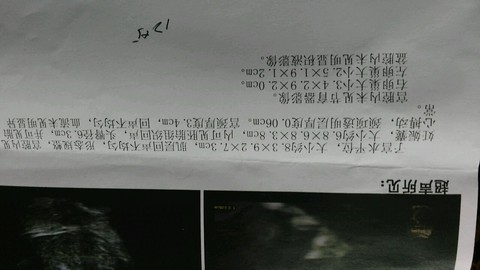 journal_insert_pic_502404248