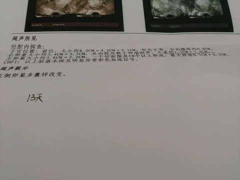 journal_insert_pic_505624836