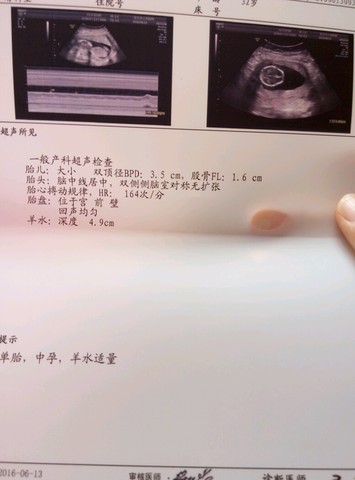 b超单看男女_发单子过来,我帮你们看_宝宝树