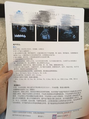 journal_insert_pic_506441516