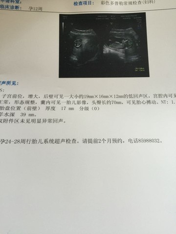 journal_insert_pic_507397386