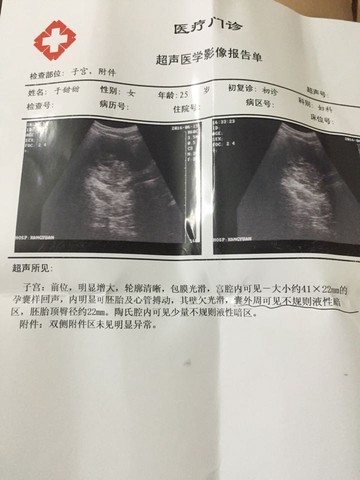 journal_insert_pic_508705002