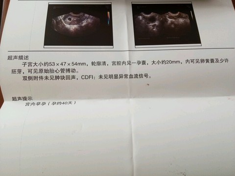 journal_insert_pic_510527689