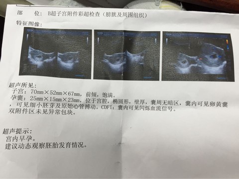 journal_insert_pic_510146029