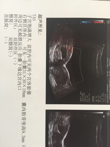 journal_insert_pic_512106303