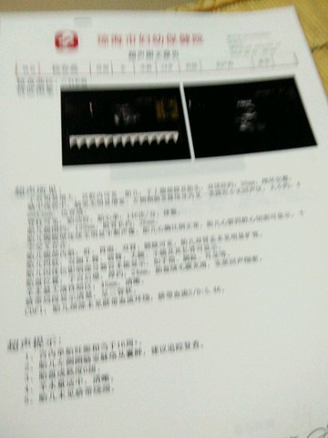 journal_insert_pic_512397166