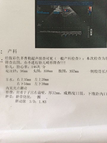 journal_insert_pic_512878294