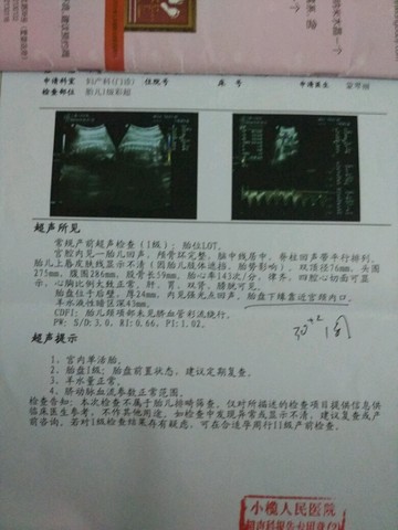 journal_insert_pic_513783358