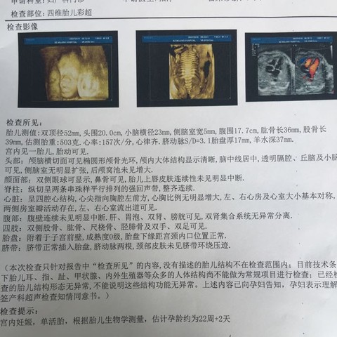 journal_insert_pic_515753148
