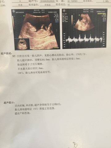 journal_insert_pic_516776607