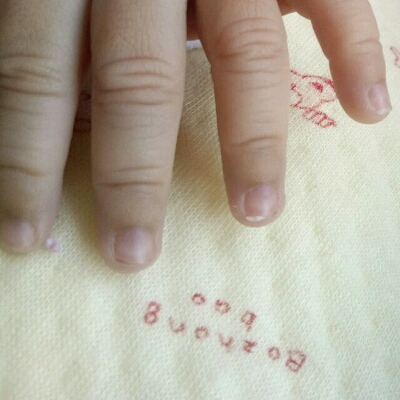 4岁儿童手指甲黑线图片