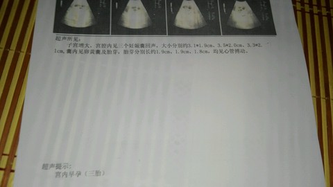 journal_insert_pic_521180926
