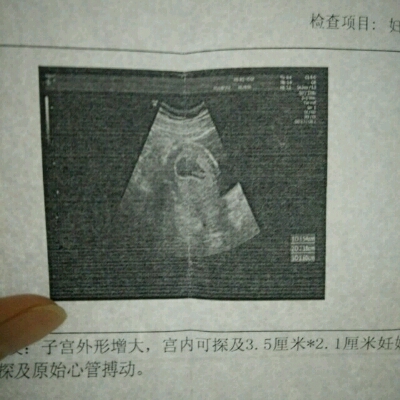 journal_insert_pic_522156337