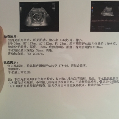 17周b超上写的脐动脉血流 Psv cm S 是什么意思 正常吗 宝宝树