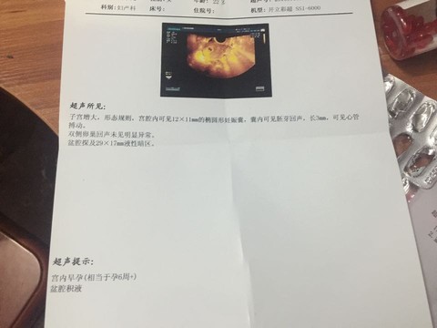 journal_insert_pic_523348330
