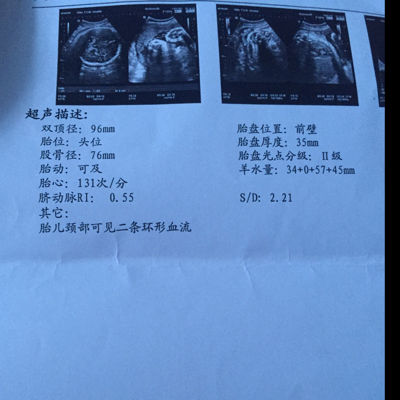 journal_insert_pic_524475269