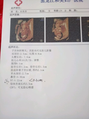 journal_insert_pic_525826632