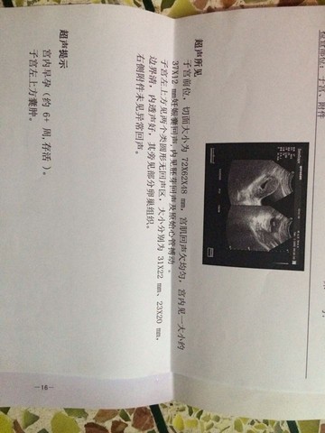 journal_insert_pic_525771718