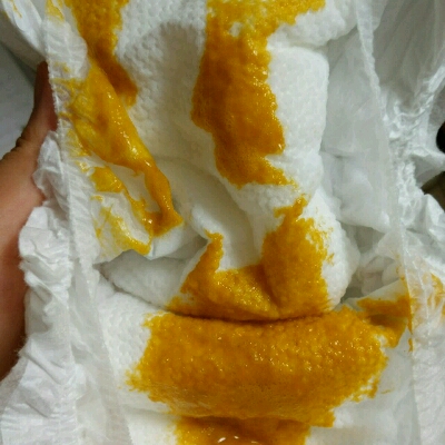 亲们,宝宝两个月5天拉这样的粑粑是拉肚子么?有小泡沫