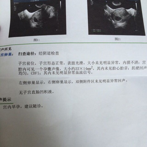 journal_insert_pic_530838460
