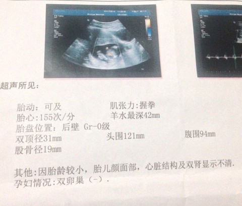 journal_insert_pic_532745419