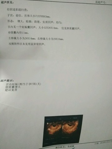 journal_insert_pic_536143861