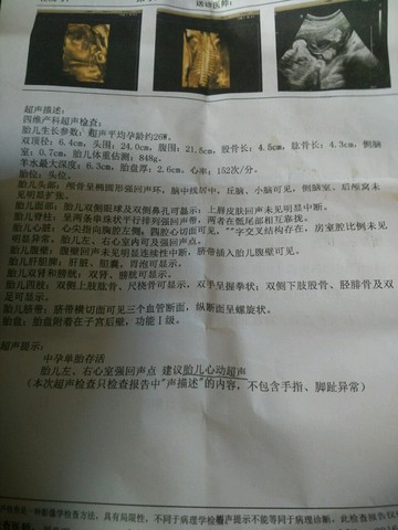 journal_insert_pic_541068055
