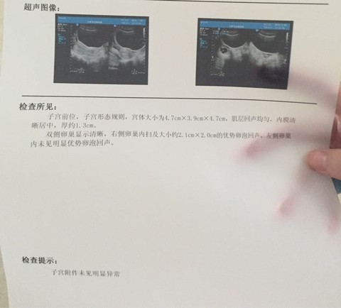 journal_insert_pic_541441798