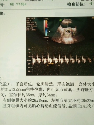journal_insert_pic_542357962