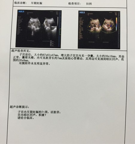 journal_insert_pic_543154680