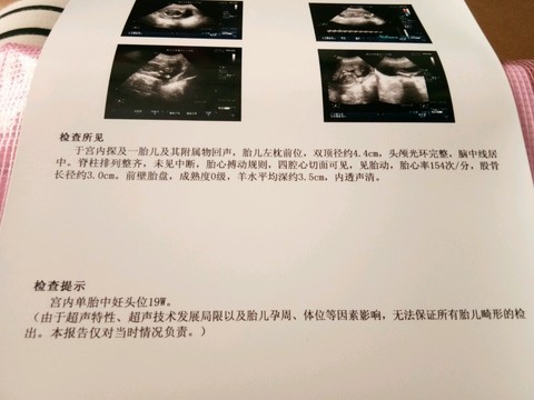 journal_insert_pic_543440693
