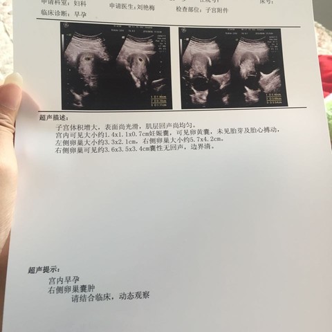 journal_insert_pic_545648727