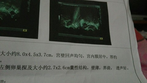 journal_insert_pic_559004148