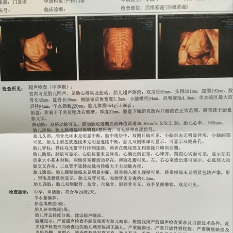journal_insert_pic_564403290