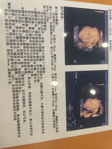 journal_insert_pic_568139649