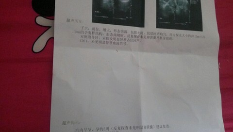 journal_insert_pic_579311120