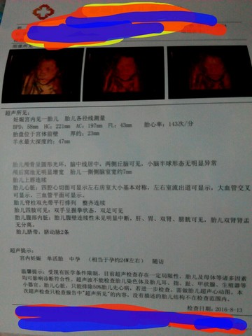 journal_insert_pic_585398696