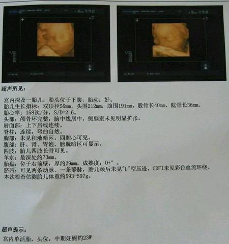 journal_insert_pic_610891163