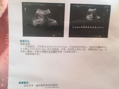 journal_insert_pic_637405551