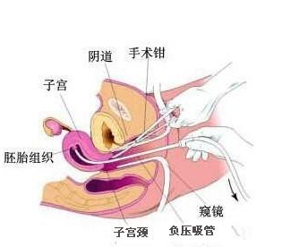 微信截图_20180123132451.png